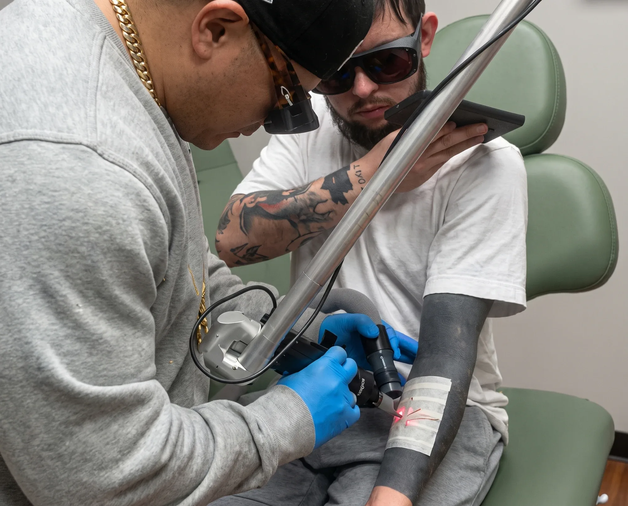 Laser Tattoo Removal