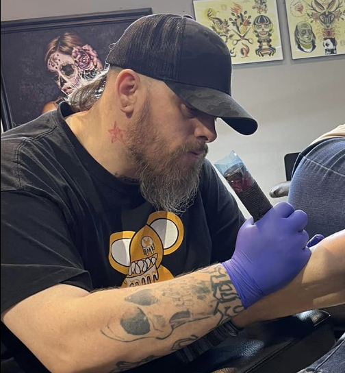Profade Tattoo Removal